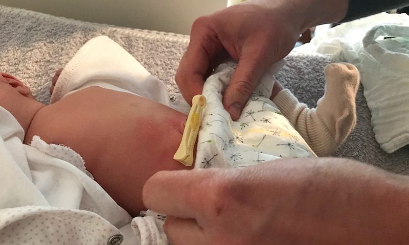 Neugeborenes Baby mit Nabelschnurklemme wickeln: Lillydoo-Windeln. Das ist gar nicht so einfach! | Mehr Infos auf Mamaskind.de